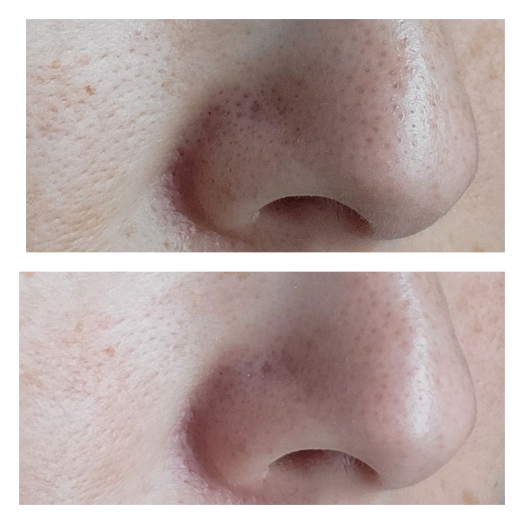 Before and after close up showing how to minimize pores on nose