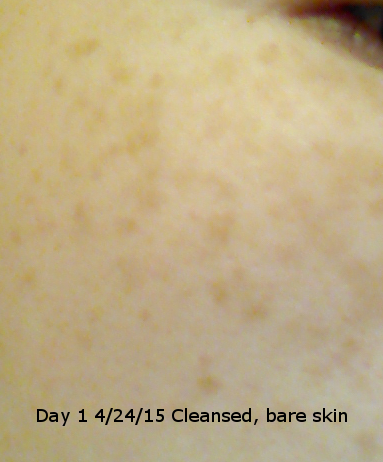 Sheet mask challenge before picture