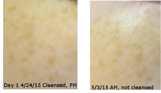 Results of whitening face masks