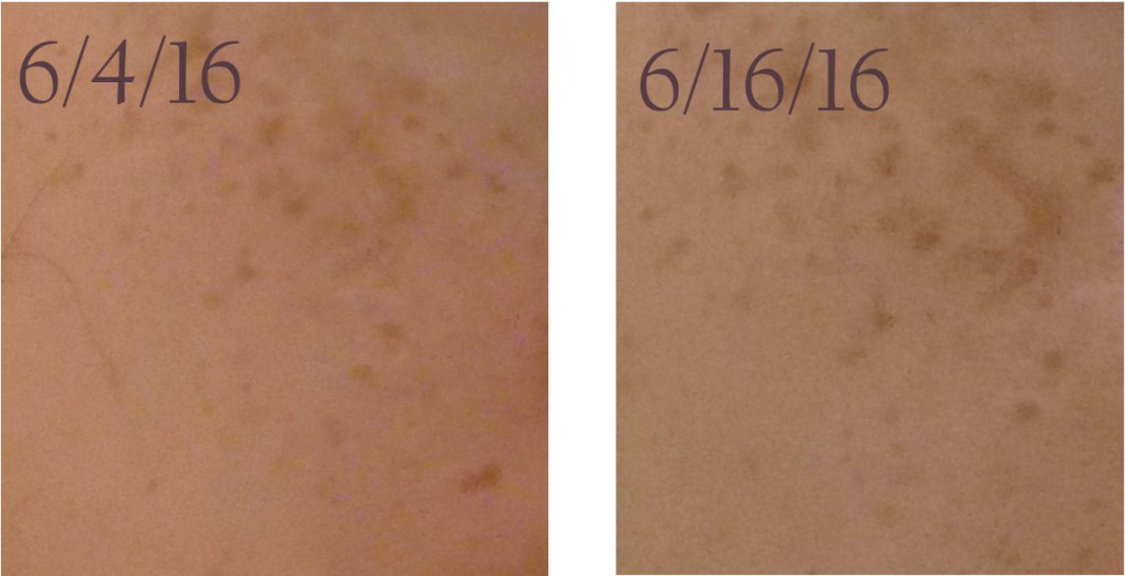 Before and after with Naruko Platinum Bright Essence Repairing Complex