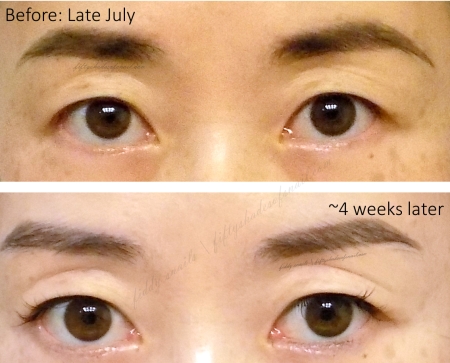 Naruko miracle essence skin whitening before and after